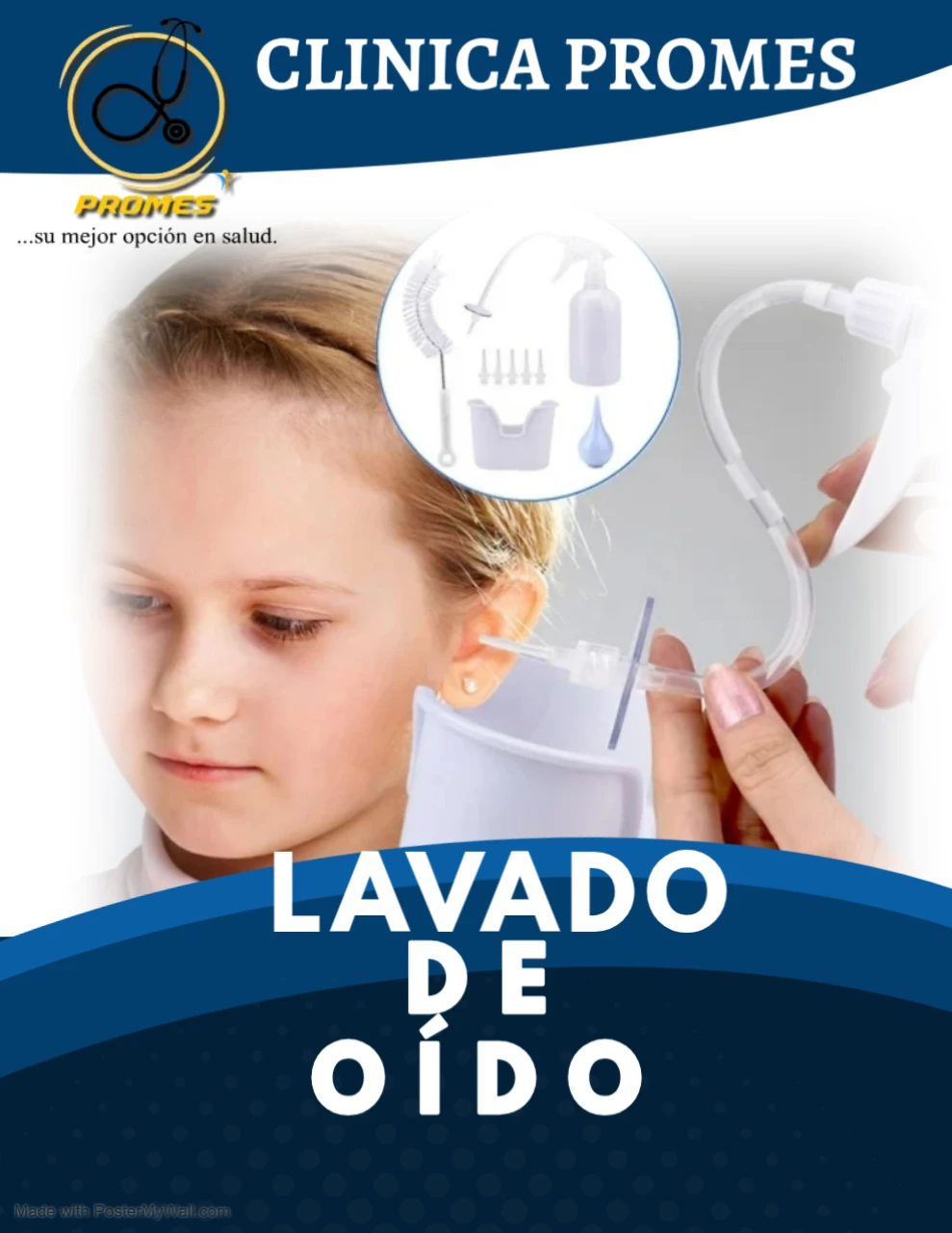 Lavado de Oído